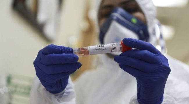 Koronavirüste son 24 saat